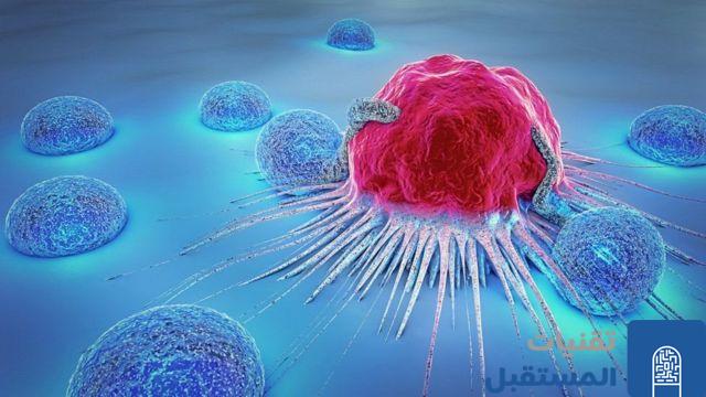 الذكاء الاصطناعي يتنبأ بفاعلية العلاج الكيميائي ضد سرطان الثدي