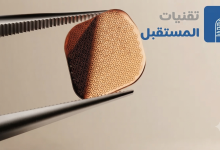 شريحة إلكترونية ثورية تحصد الموافقة الأوروبية وتنعش آمال المكفوفين